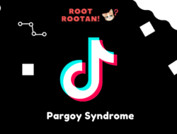 Pargoy Syndrome adalah